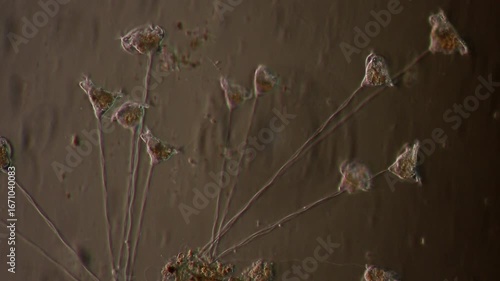 Vorticella (organism) in waste water under the microscope.