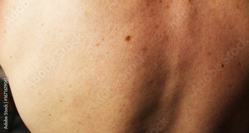 Wallpaper Mural Back of a man with freckles and moles on the skin Torontodigital.ca