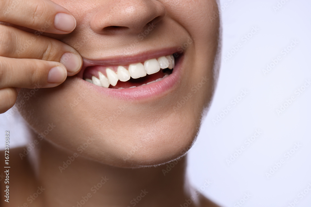 Fototapeta premium Woman showing her teeth and gums on light background, closeup