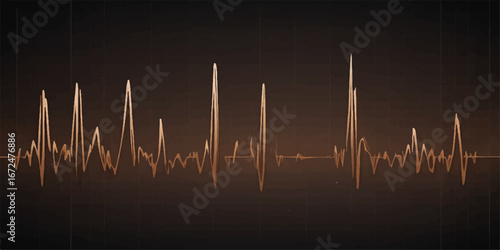 Medical heart rate graph showing an EKG pulse on a monitor with a green line
