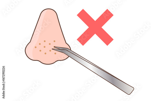 ピンセットで角栓を出すイラスト　NG 間違ったケア