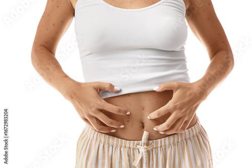 Young woman ill with chicke...