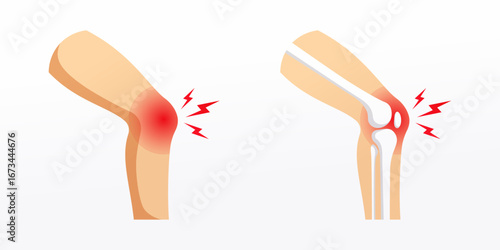 Illustration inflammation and pain in the knee joint vector isolated on white background.