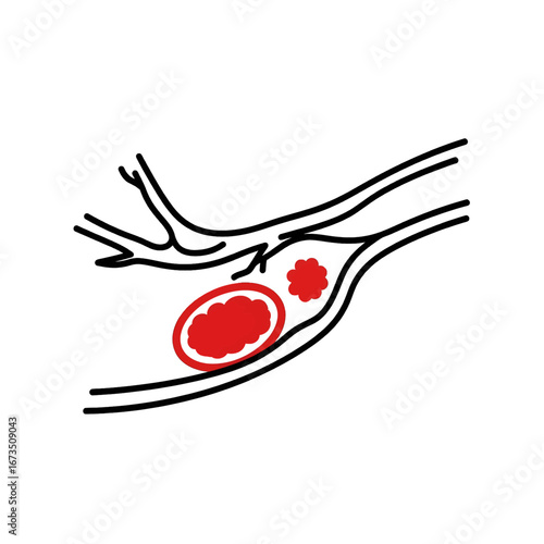 Anatomical Illustration of a Red Tumor Growth within a Biological System in Black and White