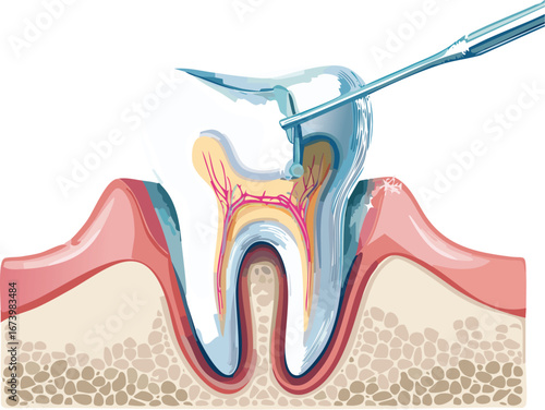 Vector illustration of dental care procedure to foster understanding and trust in oral health practices.
