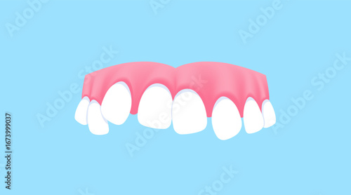 Upper teeth (Crooked) illustration vector design. Dental care concept.