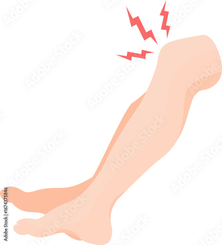 Illustration of Leg with Knee Pain