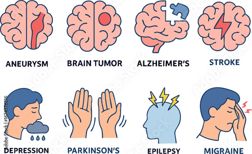 This image is an illustrated medical chart depicting various brain and neurological disorders, including aneurysm, brain tumor, Alzheimer’s, stroke, depression, Parkinson’s, epilepsy, and migraine wit