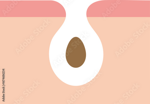 피부