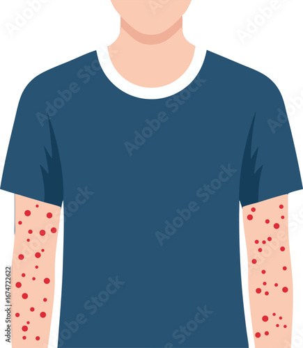 Person with Red Rash Spots on Both Arms Representing Skin Allergy or Infection Illustration