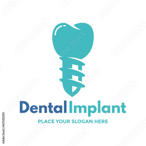 A clean logo of a stylized dental implant, ideal for dental clinics, orthodontists, or any business providing dental services and oral care solutions.