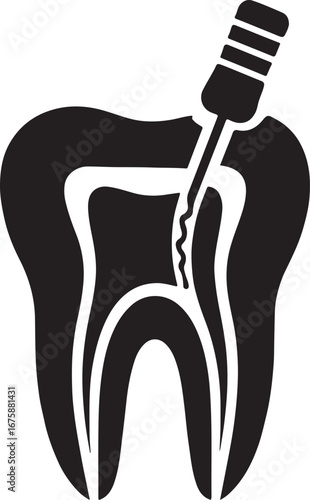 Black silhouette of tooth with root canal illustration, ideal for dental and endodontic designs.