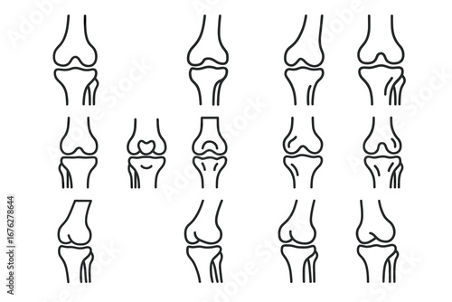 Various knee joint conditions and structures illustrated in diagram