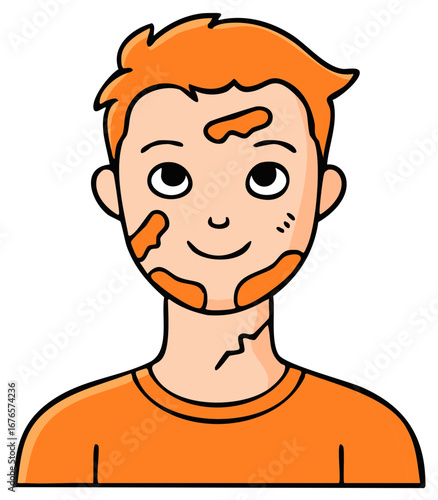 Cartoon illustration of a young man with orange patches on his face and neck, wearing an orange shirt.