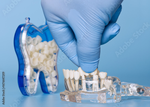 Placing dental crown on model with gloved hand