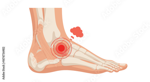 Anatomical Illustration of Human Foot and Ankle with Red Pain Indication Showing Joint Discomfort and Inflammation