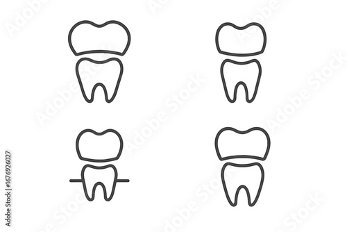 Dental crown procedure line icon set. Tooth restoration, implantation concepts. Simple vector art for dentistry, stomatology, oral health care. Minimalist pictogram for web design.