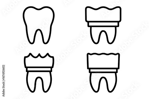 Dental crown installation process icon set. Tooth restoration treatment steps. Dentistry, stomatology procedure concept. Molar cap, veneer line art symbol for web, apps. Vector.