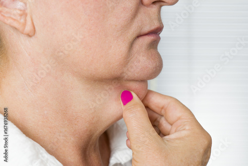 Older women holds the sagging neck skin