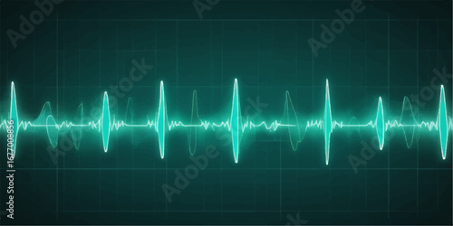 Medical heart rhythm graph displaying green and blue electrocardiogram sound waves