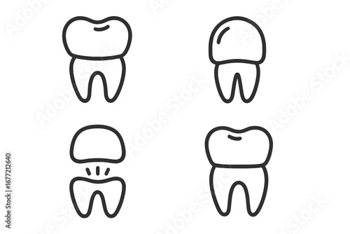 Dental crown installation procedure icon set. Tooth restoration and treatment process. Dentistry, stomatology concepts. Modern outline style vector icons for web and apps.