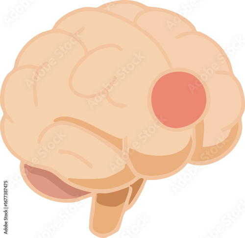 This illustration depicts a human brain with a highlighted red circular spot, symbolizing brain injury, stroke, or localized neurological damage.