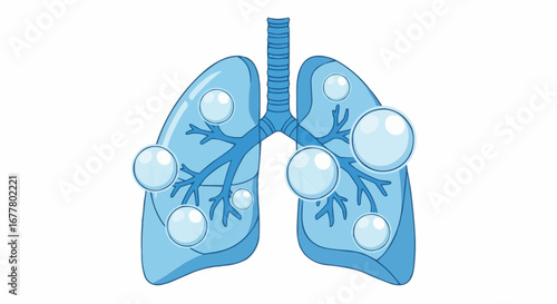 Health, medicine and nursing vector  illustration of lungs with bubbles showing respiratory infection or disease concept and lung health awareness