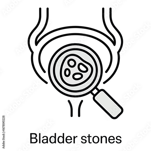 Bladder stones diagnosis with magnifying glass in a human anatomy illustration image  vector silhouette