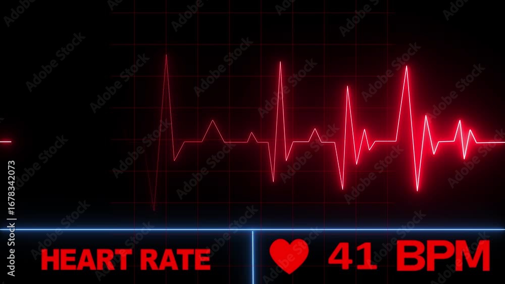 Heart Rate Monitor Animation with ECG Pulse Line and 80 BPM Display on ...