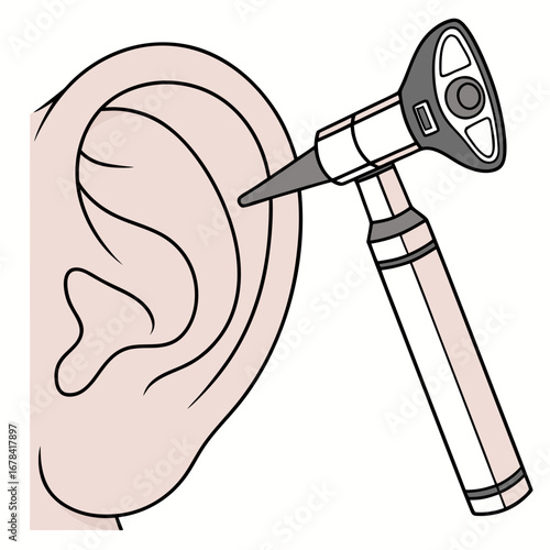 Close up illustration of an otoscope examining the inside of a human ear against a white background