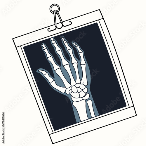 Hand x ray with visible bones and joints held by a clip on a white background