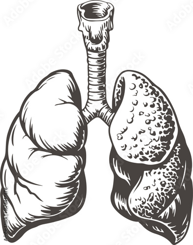 Anatomical Lungs and Trachea Illustration for Medical and Educational Use