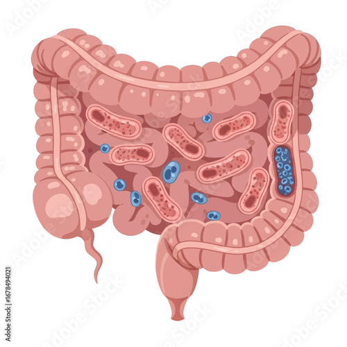 Detailed Illustration of Human Colon with Bacteria and Microbes in Pink and Blue