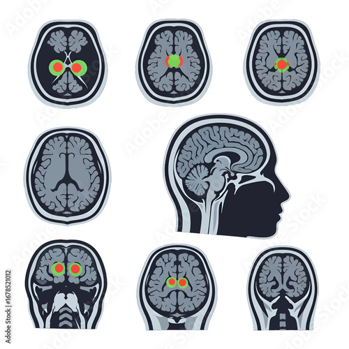 Medical Brain Scan Anatomy Illustration with Green and Red Regions on White Background