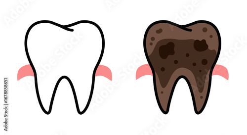 Cartoon Vector Outline of Rotten Tooth and Healthy Tooth Illustration