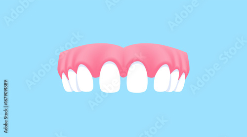 Upper teeth (Diastema V.2) illustration vector design. Dental care concept.