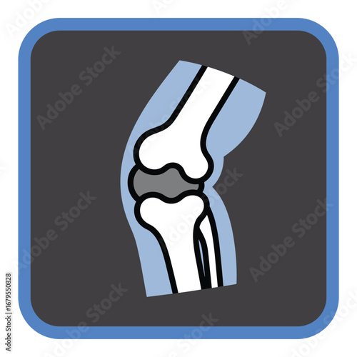 Human Knee Joint Anatomy Illustration – Vector Diagram of Femur, Tibia, Patella, and Cartilage for Medical Education