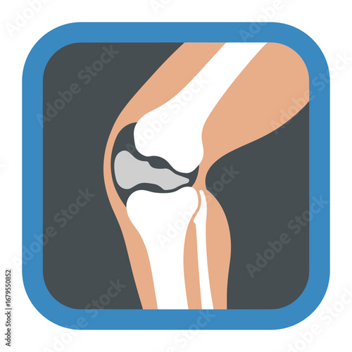 Human Knee Joint Anatomy Illustration – Vector Diagram of Femur, Tibia, Patella, and Cartilage for Medical Education