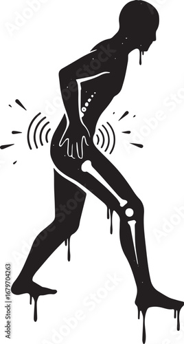 Conceptual Sciatica Illustration of Painful Lower Back and Leg C