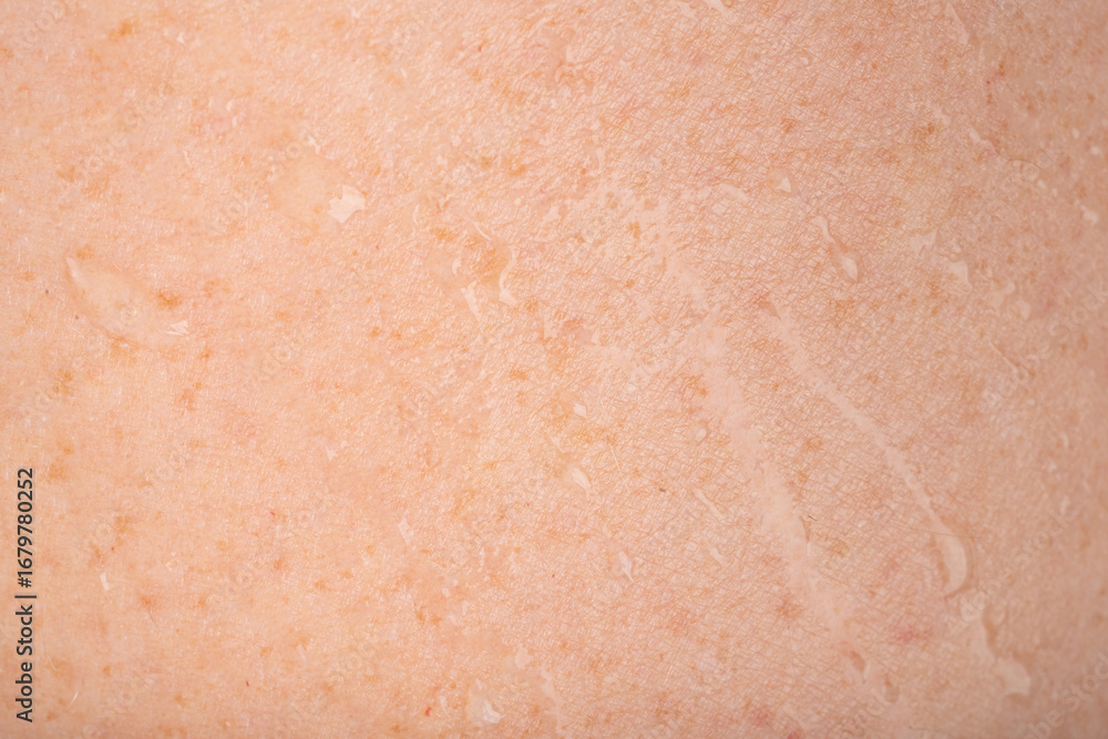 Fototapeta premium Wet human skin with water drops closeup. Sweat healthy body, macro shower drops on woman skin