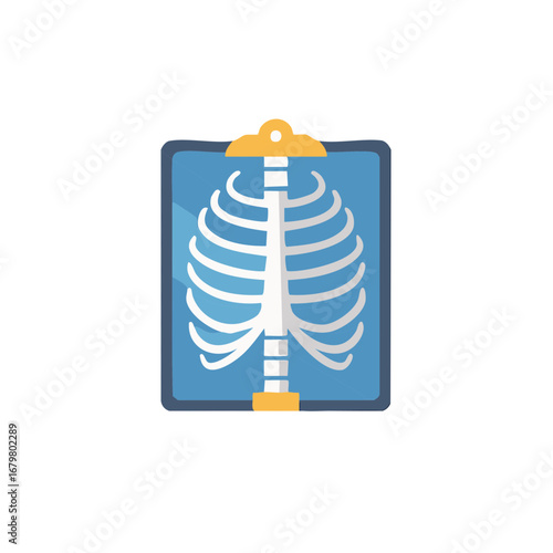 Medical Rib Cage X-Ray Film on a Clipboard with a Yellow Clip