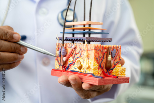 Hair transplant, Asian dermatologist doctor holding skin structure anatomy model for treatment in hospital.