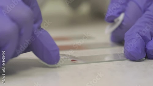 blood applied to glass for analysis