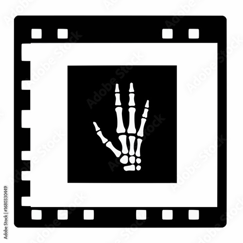 X-ray image of a hand, displayed within a film negative frame.