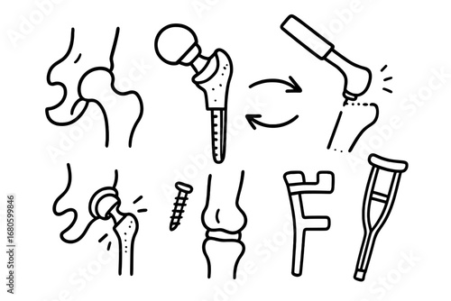 Hip Replacement Doodle. Hand-drawn doodle illustration hip replacement artificial joint, metal implant, hip prosthesis, surgery