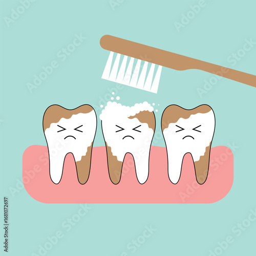 Set of dental cleaning and whitening teeth concept. comparison of clean and dirty tooth. dental health and oral hygiene poster for dentistry. examination teeth, whitening and repair. vector design 