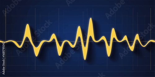 Heartbeat electrocardiogram pulse rate on a green monitor with a medical line chart