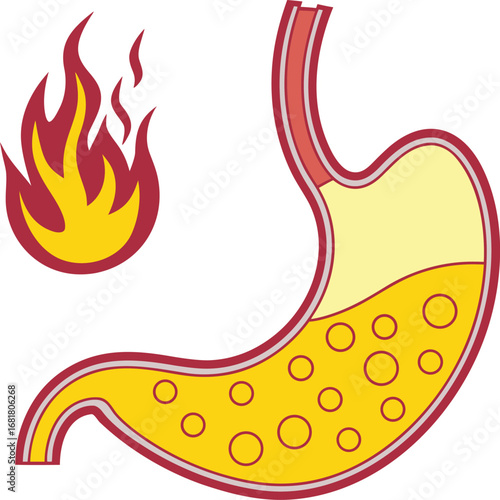 Illustration of a stomach with flames, representing heartburn or indigestion