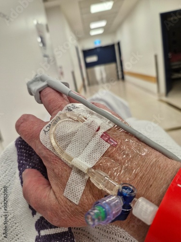 Cannula in hand 