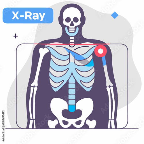 Radiology Concept – Health Care, Disease Diagnosis, X-ray and Computed Tomography of Human Body Cartoon Vector Illustration
